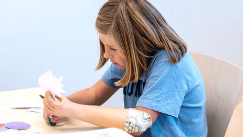 Barn med dysmeli tränar olika färdigheter i grupp under ledning av arbetsterapeuterna på dysmeli- och armprotesenheten.