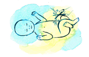 Illustration i vattenfärg av en nyfödd bebis som får navelsträngen klippt.